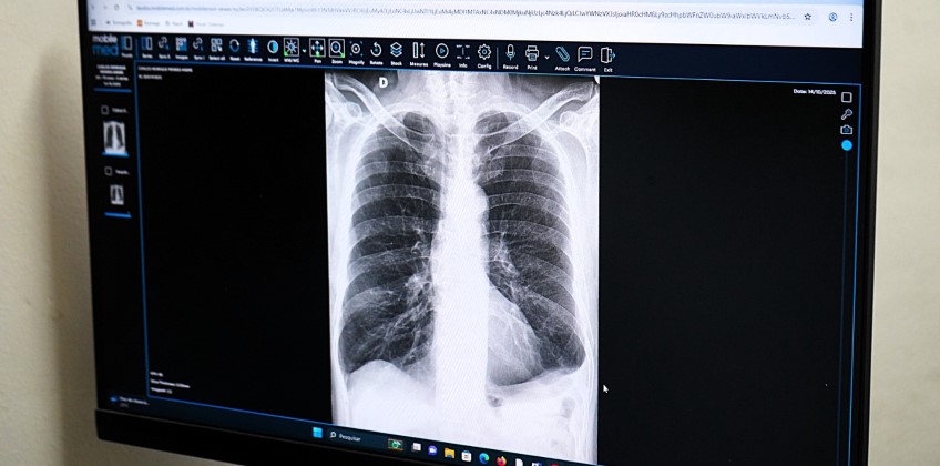 Saúde pública de VR ultrapassa 50 mil exames analisados com auxílio da Inteligência Artificial